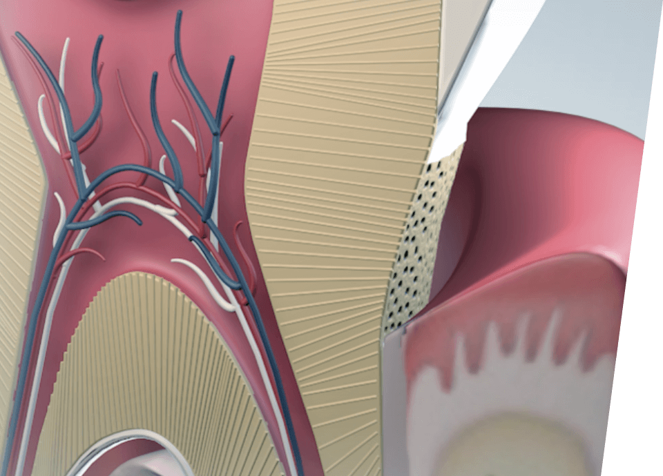 Microrepair penetration
