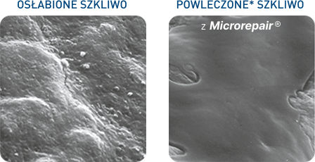 Eroded Enamel