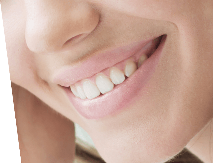 Three actions of Microrepair