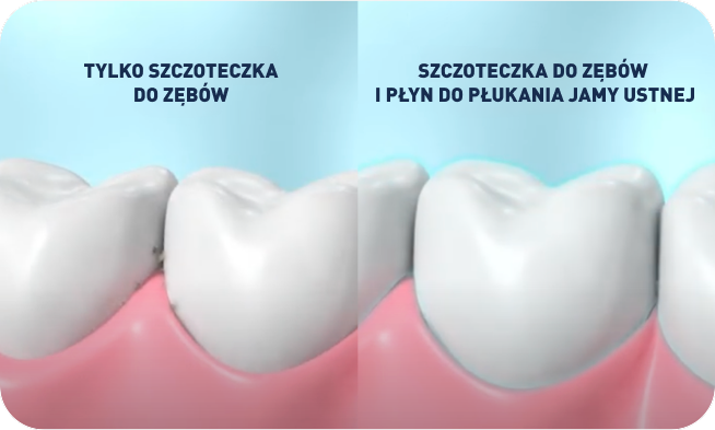 Toothbrush Only vs Toothbrush and Mouthwash