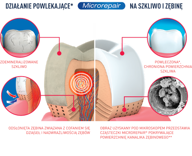 How microRepair works