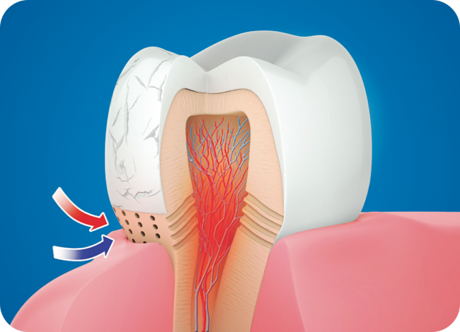 Causes of sensitive teeth